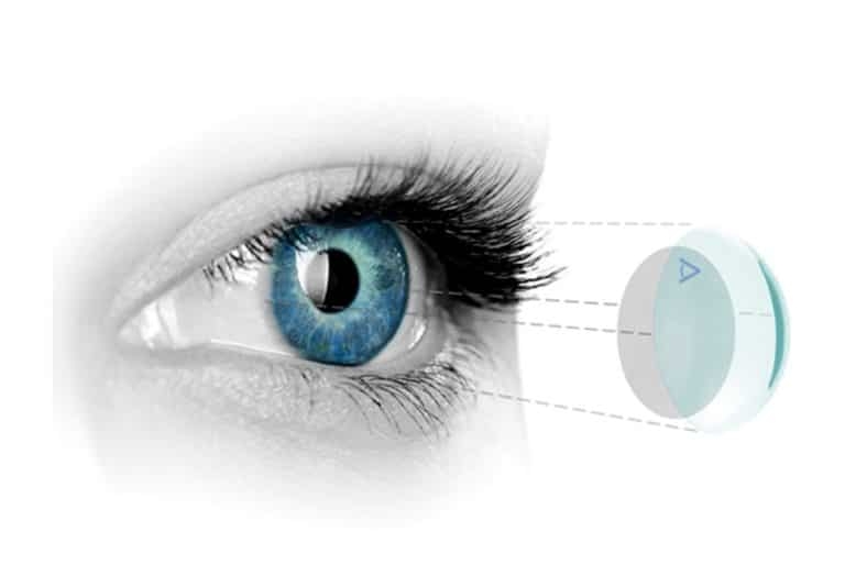 کالای پزشکی نور طب
 - nurteb - مظنه
