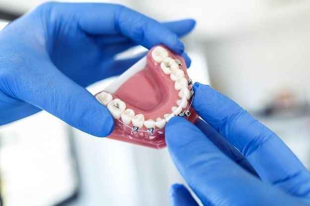 فروشگاه کیمیا پرتو دندان-partudandan-مظنه